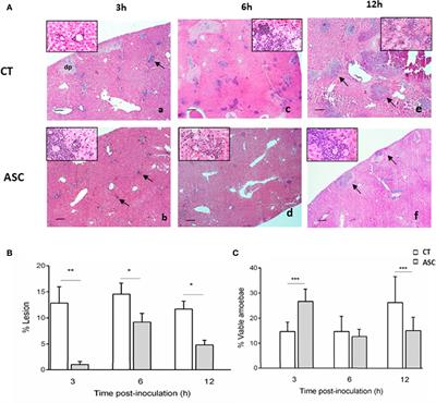 Ascorbic Acid Ameriolates Liver Damage by Myeloperoxidase Oxidative Products in a Hamster Model of Amoebic Liver Abscess